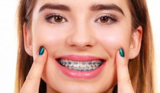 آخرین اخبار ارتودنسی