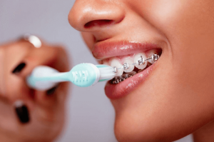 بهداشت دهان در هنگام درمان ارتودنسی