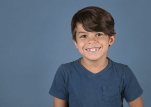 مواردی درباره‌ی دندان های بیرون زده 