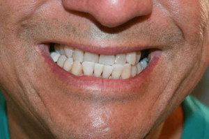 علل ناهنجاری های دندانی
