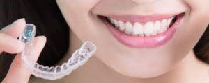 Orthodontics with transparent plates