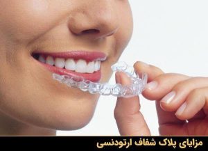Orthodontics with transparent plates