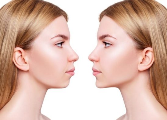 Correction of jaw growth and treatment of jaw problems