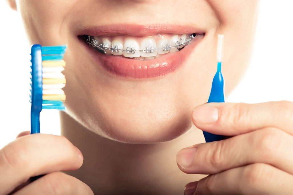 toothbrushes and brushing methods during Orthodontic