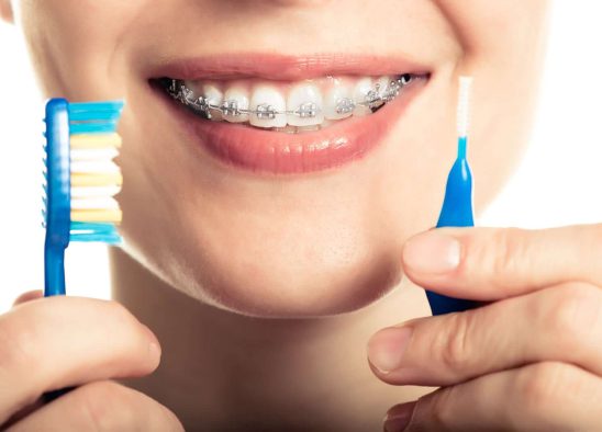 toothbrushes and brushing methods during Orthodontic