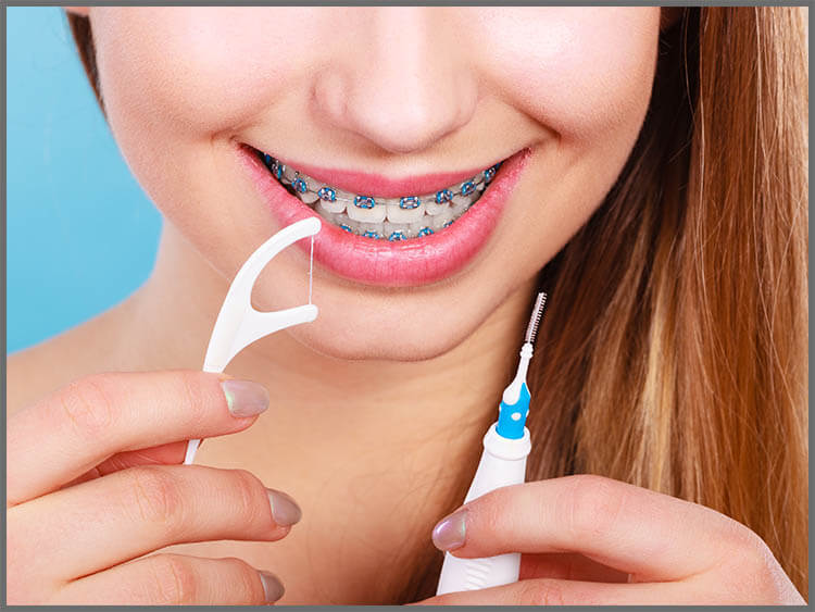 How to take care of your teeth & braces during orthodontics