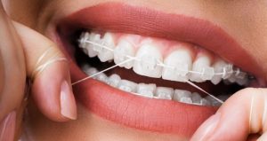 use Super Floss floss in orthodontics