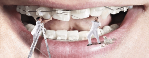 Orthodontic benefits
