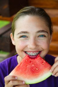 Soft fruits orthodontics
