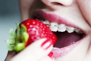 Soft fruits orthodontics