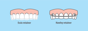 essix and hawley retainer Orthodontic