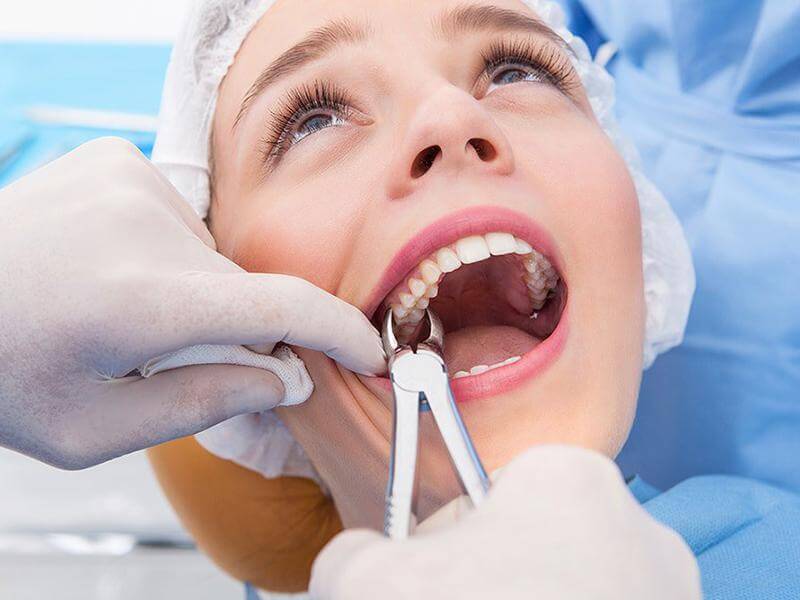 Extraction of teeth orthodontics