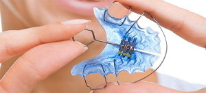 How to use removable orthodontics