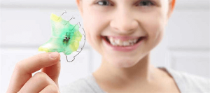 Important points for using removable orthodontics