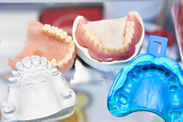Molding of teeth and types of dental molding materials