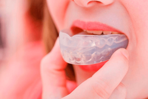 Dental Mouth Guards