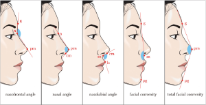 nose nasal cosmetic surgery