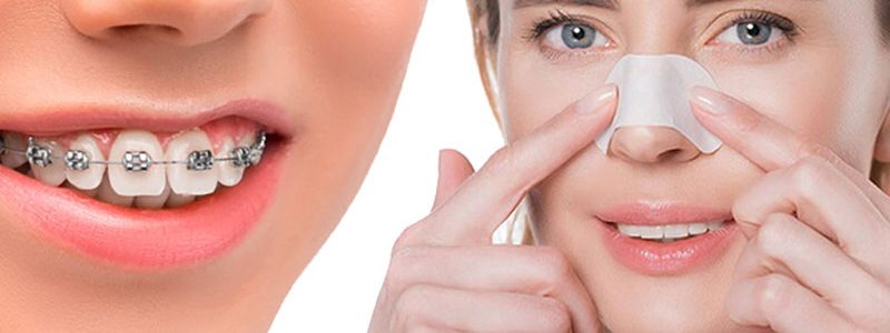 nose surgery and orthodontics