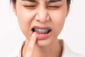 pain during orthodontics..