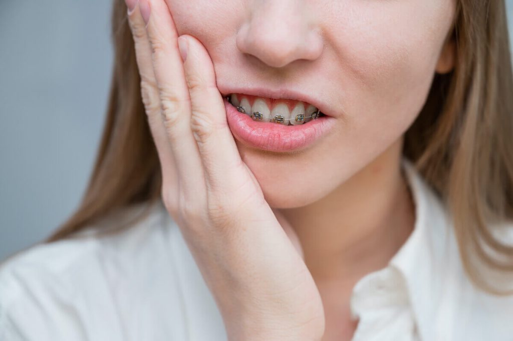 what-does-it-mean-to-dream-about-braces