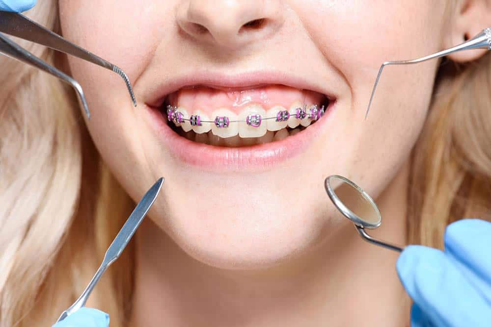 When is the best age to start orthodontic treatment