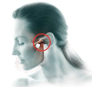 Temporal joint