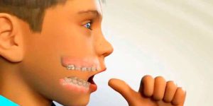thumb sucking