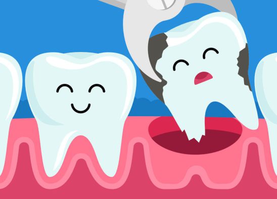 علل کشیدن دندان در دندانپزشکی