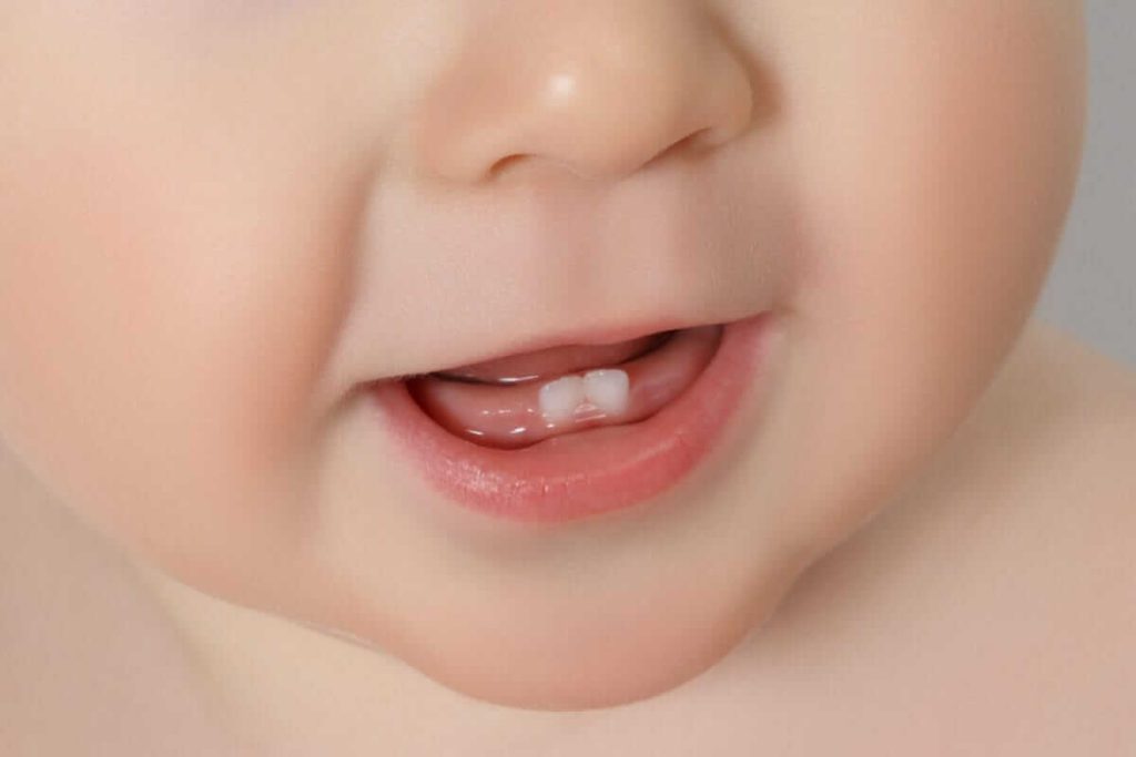 Growth problems of milk teeth and its relationship with orthodontics