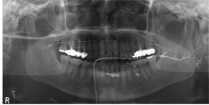 How to diagnose a problem in the salivary glands