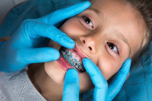 Orthodontics of primary teeth