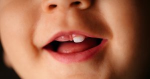 The time of eruption of milk teeth