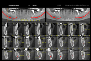 رادیوگرافی CBCT