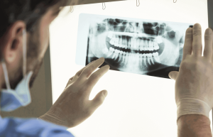 تشخیص بیماری های دندانی با رادیوگرافی CBCT