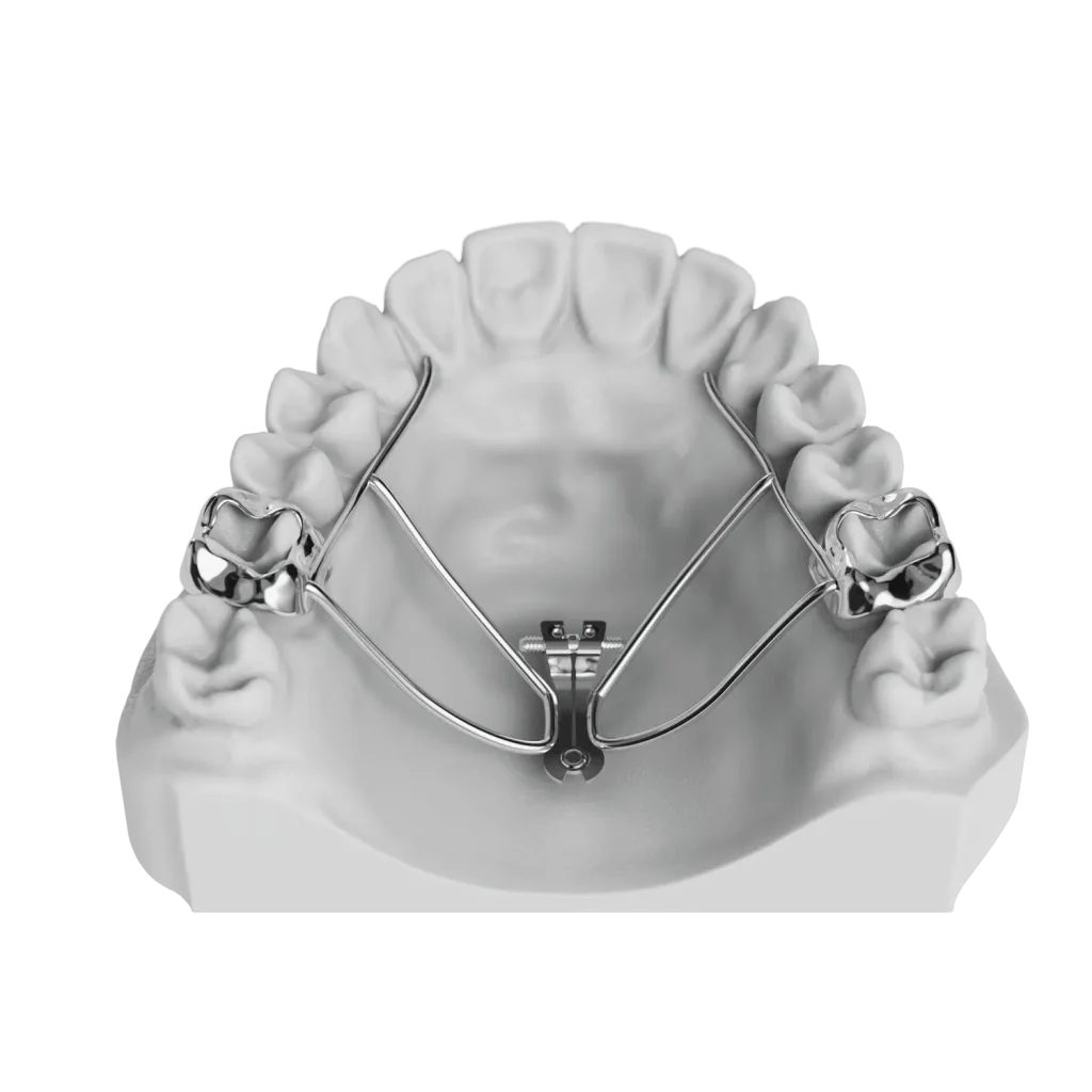 دستگاه اکسپانشن گسترش عرضی فک به روش ثابت (RPE)