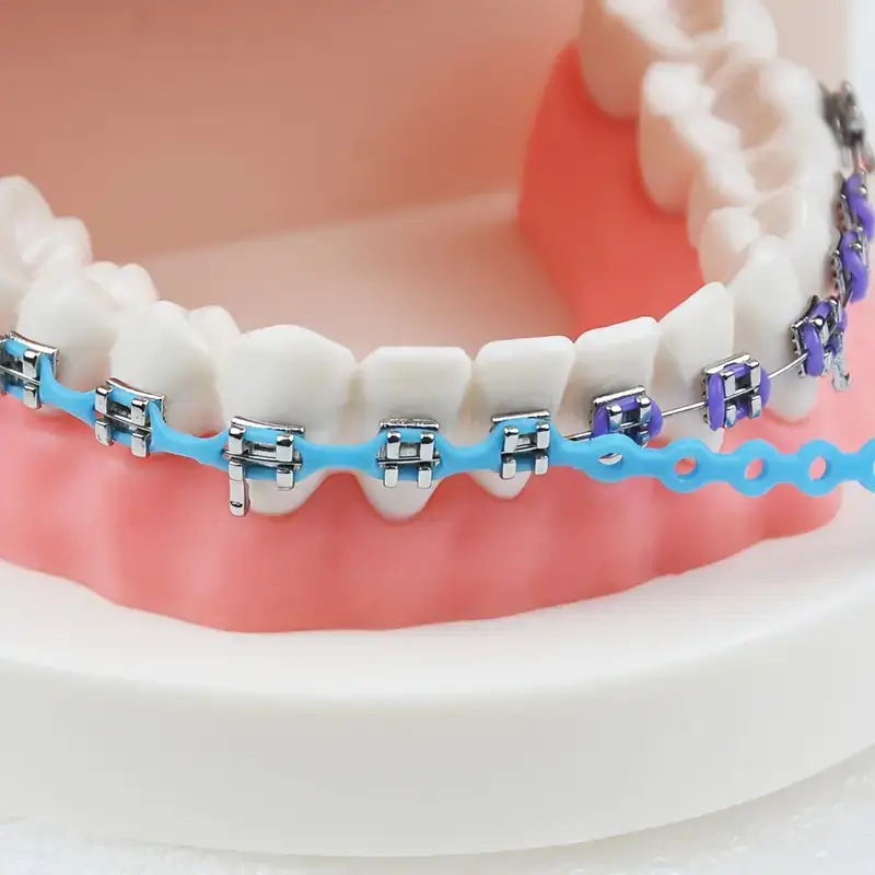 الاستیک چین alstic chain در ارتودنسی