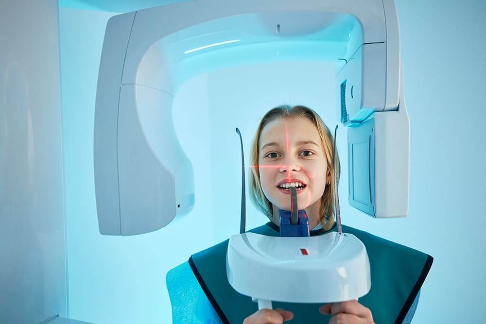 رادیوگرافی پری اپیکال سفالومتری PA Cephalometry