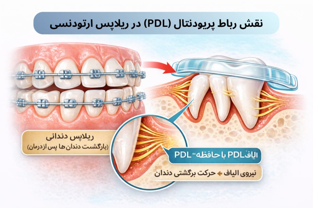 نقش رباط پریودنتال (PDL) در ریلاپس ارتودنسی و حافظه الیاف اطراف دندان که باعث حرکت برگشتی دندان‌ها می‌شود