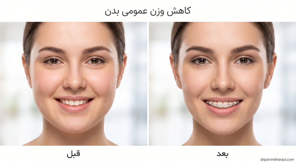 مقایسه قبل و بعد تغییرات چهره جهت بررسی اینکه آیا ارتودنسی باعث لاغری صورت میشود - دکتر پروین خرازی