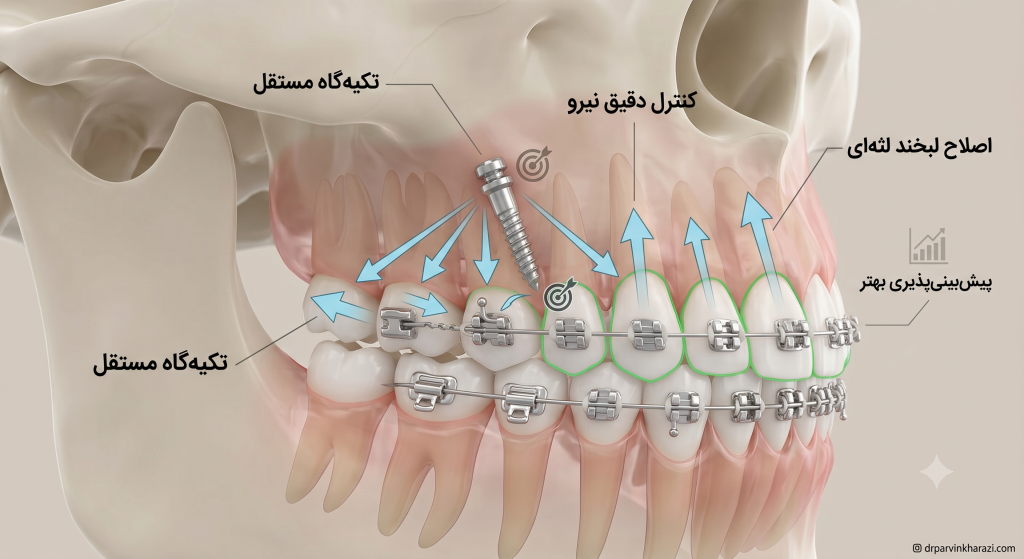 اینفوگرافیک مزایای مینیاسکرو ارتودنسی و کاربرد آن در اصلاح لبخند