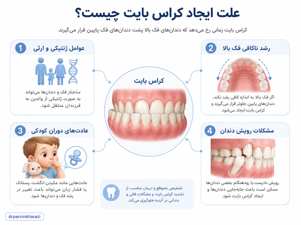 علت ایجاد کراس بایت در ارتودنسی شامل عوامل ژنتیکی، رشد ناکافی فک بالا، عادات دوران کودکی و مشکلات رویش دندان