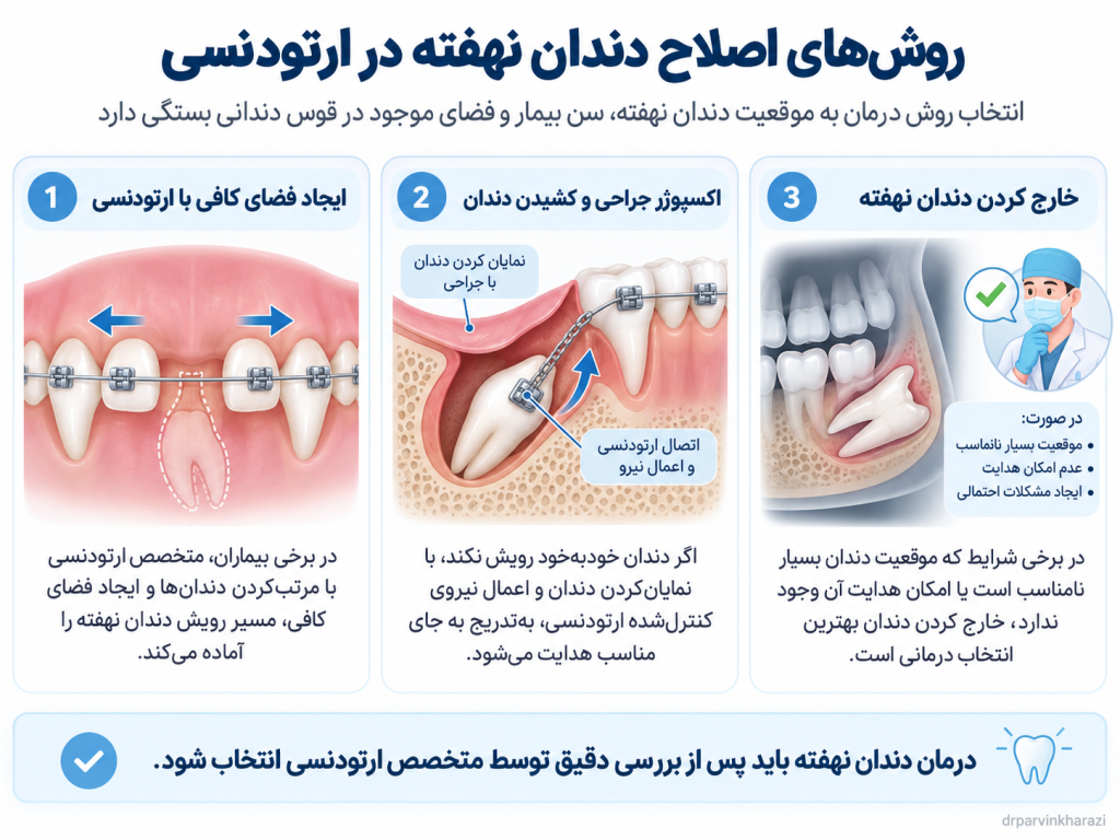 اینفوگرافیک روشهای اصلاح دندان نهفته در ارتودنسی شامل ایجاد فضای کافی، اکسپوژر جراحی و کشیدن دندان، و خارج کردن دندان نهفته