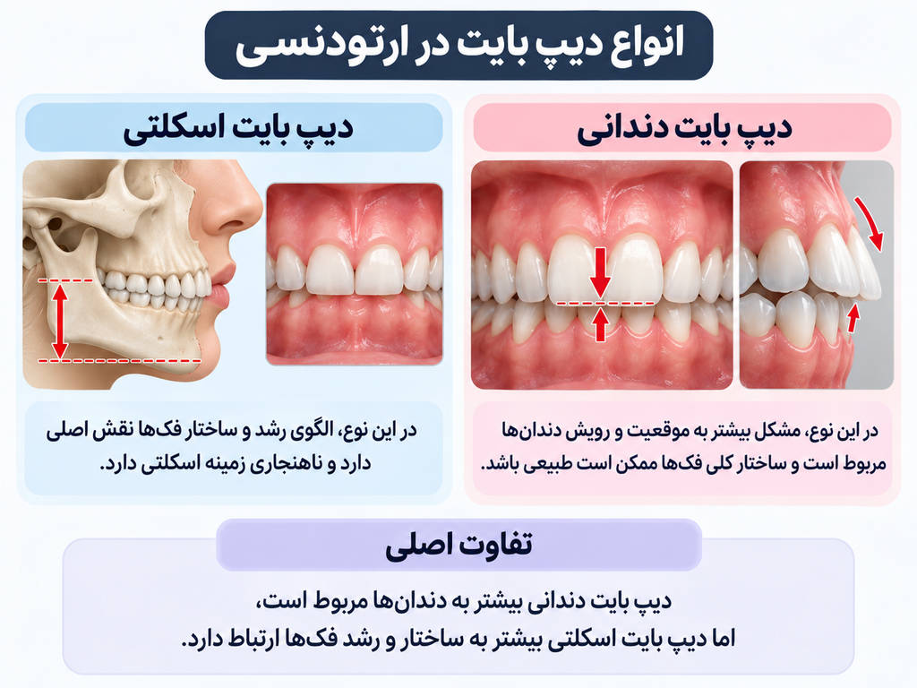 انواع دیپ بایت در ارتودنسی شامل دیپ بایت دندانی و دیپ بایت اسکلتی با نمایش تفاوت در موقعیت دندان‌ها و ساختار فک