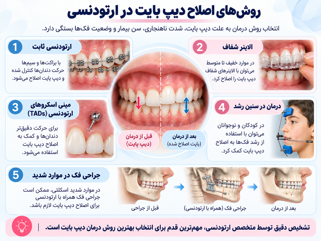 روش‌های اصلاح دیپ بایت در ارتودنسی شامل ارتودنسی ثابت، الاینر شفاف، مینی اسکروهای ارتودنسی (TADs)، درمان در سنین رشد و جراحی فک