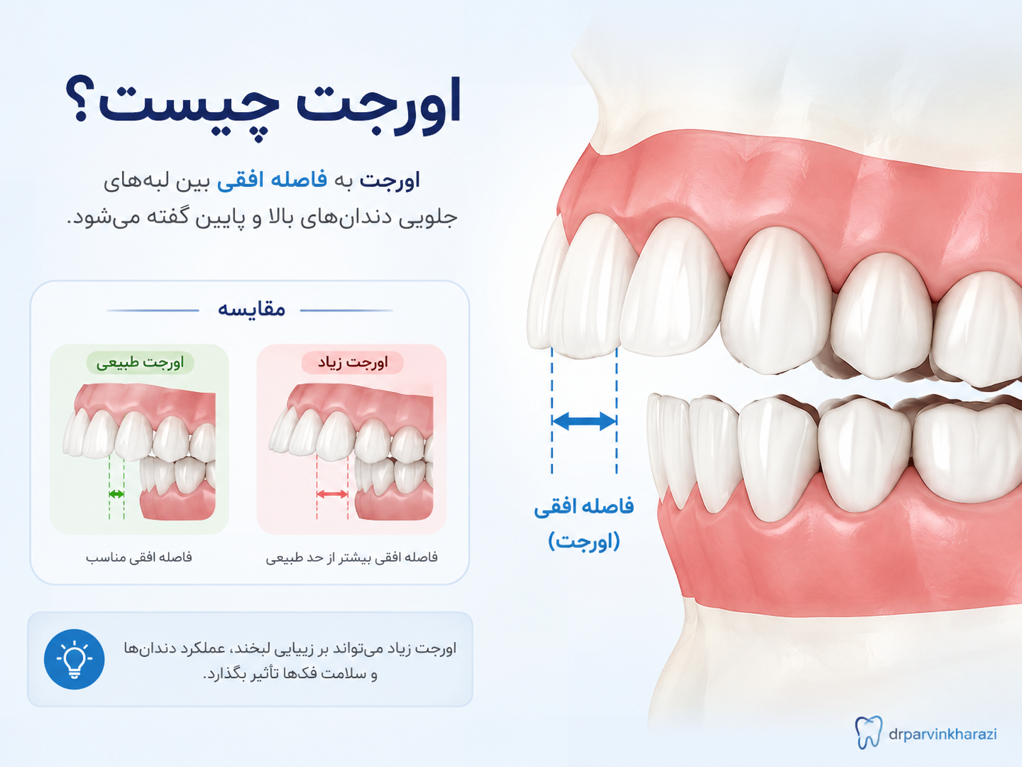 اورجت چیست؟