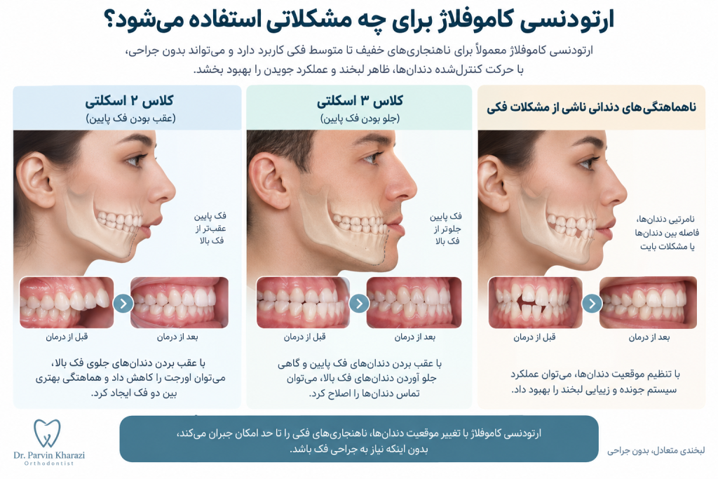 ارتودنسی کاموفلاژ برای اصلاح کلاس ۲ و ۳ اسکلتی و ناهماهنگی‌های دندانی بدون جراحی فک