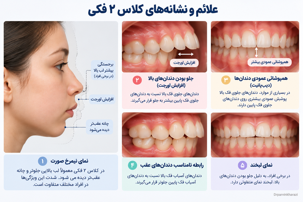 علائم و نشانه‌های ناهنجاری کلاس ۲ فکی؛ عقب بودن چانه و افزایش اورجت دندان‌ها