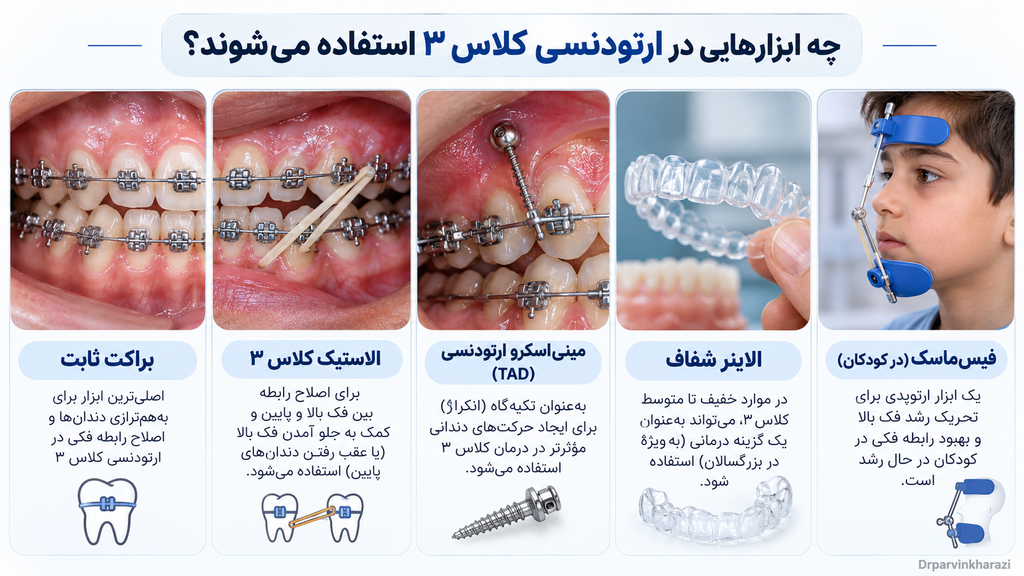 ابزارهای مورد استفاده در ارتودنسی کلاس ۳ شامل براکت ثابت، الاستیک کلاس ۳، مینیاسکرو ارتودنسی، الاینر شفاف و فیسماسک