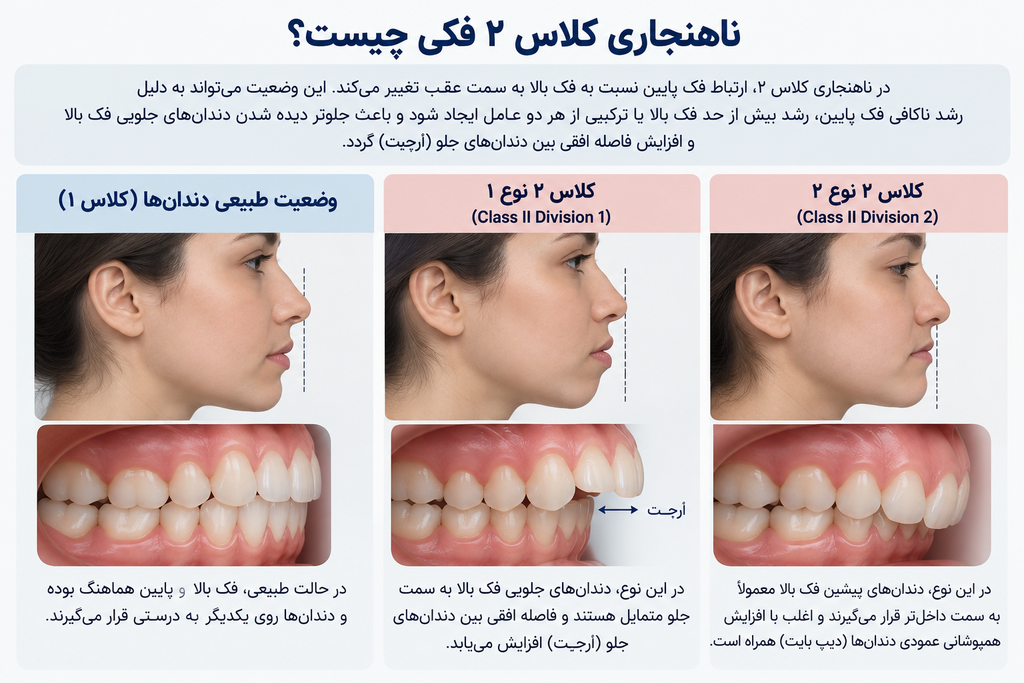 مقایسه ناهنجاری کلاس ۲ فکی با رابطه طبیعی فک‌ها و دندان‌ها