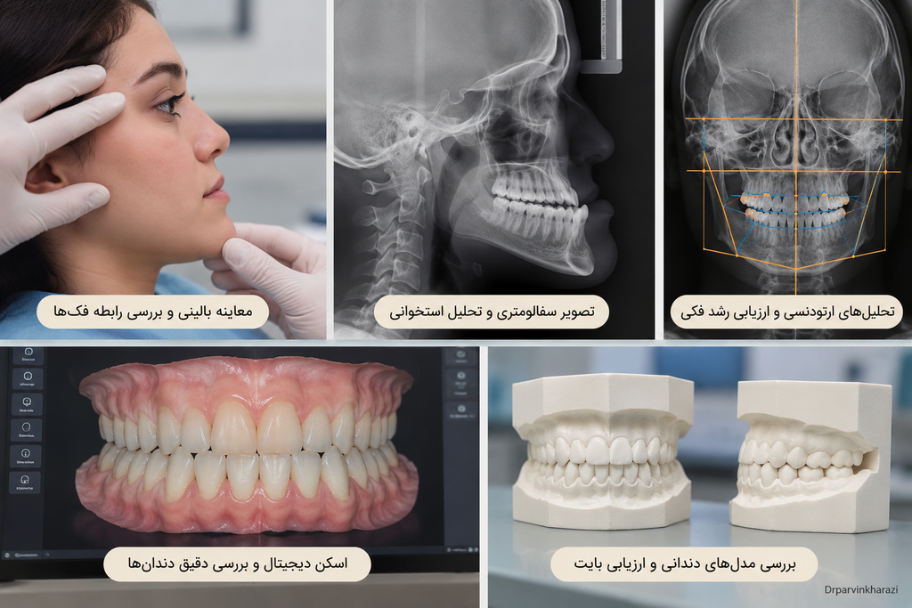 تشخیص ناهنجاری کلاس ۳ فکی با معاینه بالینی، سفالومتری، اسکن دیجیتال و بررسی مدلهای دندانی